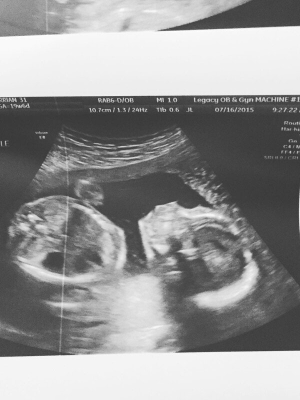 A photo of an ultrasound of a baby.
